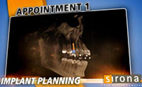 3D Implants Guided Implant Placement 6